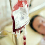 transfuzija-na-krv (1)