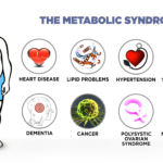 metabolen sindrom