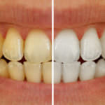 teeth