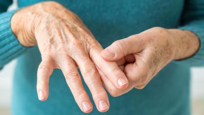 Ревматскиот артритис почесто се јавува кај личности со одредени ...