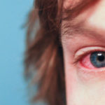 1679-Cat_allergies-1296×728-cat_allergic_symptoms