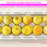 rak-na-dojka