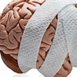 povreda-na-mozok-demencija (1)