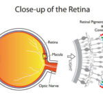 retina