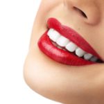 whiteteeth