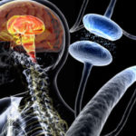 parkinsonova-bolest (2)
