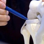 thumbnail_knie129_v-contentxl