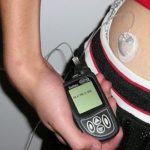 Insulin_pump_with_infusion_set