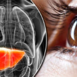 Liver-disease-824228