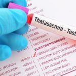 blood-sample-thalassemia-test-requisition-form-109080728