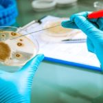 Germs growing on an agar plate in laboratory