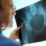 osteo