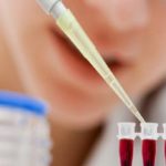 tularemija2