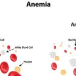 ANEMIJA1