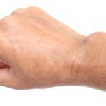GANGLION 1