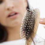 alopecija
