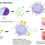 Mechanism of allergy (drug,hay fever, asthma,.