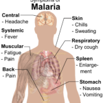malarija (1)