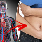 Abdominal-aortic-aneurysm-Symptoms-of-the-condition-include-pain-in-the-abdomen-735893