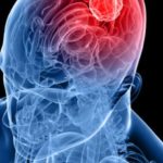 TUMOR
