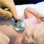 apgar (1)