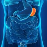 splenomegalija (1)