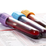 Blood test, blood samples on a laboratory form