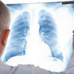 asthma2