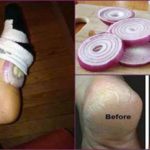 Why-Should-You-Put-Onions-In-Your-Socks-Before-Going-To-Bed