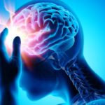 EPILEPSIJA
