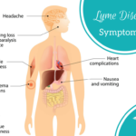 Learn-the-symptoms-for-Lyme-disease