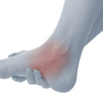 Pain in a woman ankle