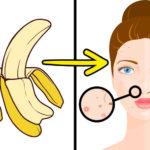 kora od banana1