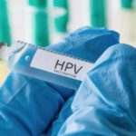 HPV2