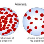 anemija