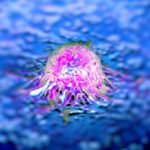 prostate-cancer-cell-03-05-18