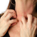 Woman scratching her neck