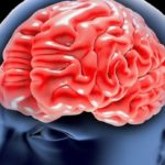26272662 – cerebral aneurysm, brain head