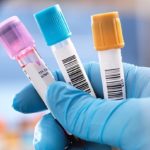Hereditary-Angioedema-HAE-Delayed-Diagnosis-is-Common-722×406