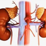 Kidney-Disease