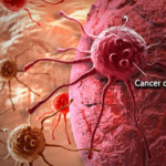 cancer
