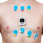 holter-ecg