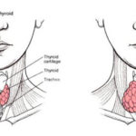 iodine-thyroid
