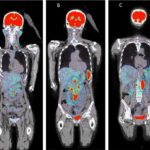 pet ct