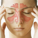webmd_composite_image_of_sinuses