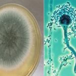2Figuras-Aspergillus-fumigatus