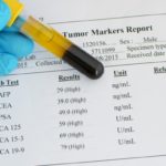 TUMOR MARKERI