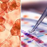 Candida-auris-yeast-infection-NHS-antibiotic-resistance-CDC-1110806