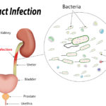 How-to-Naturally-Heal-Urinary-Tract-Infection_FT