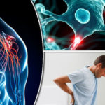MS-symptoms-Multiple-sclerosis-is-a-neurological-condition-839762